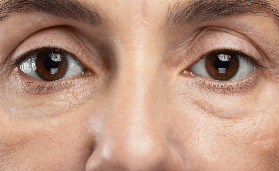 Picture of middle aged woman's face close up to introduce an article on how mothers are often aging faster than presidents